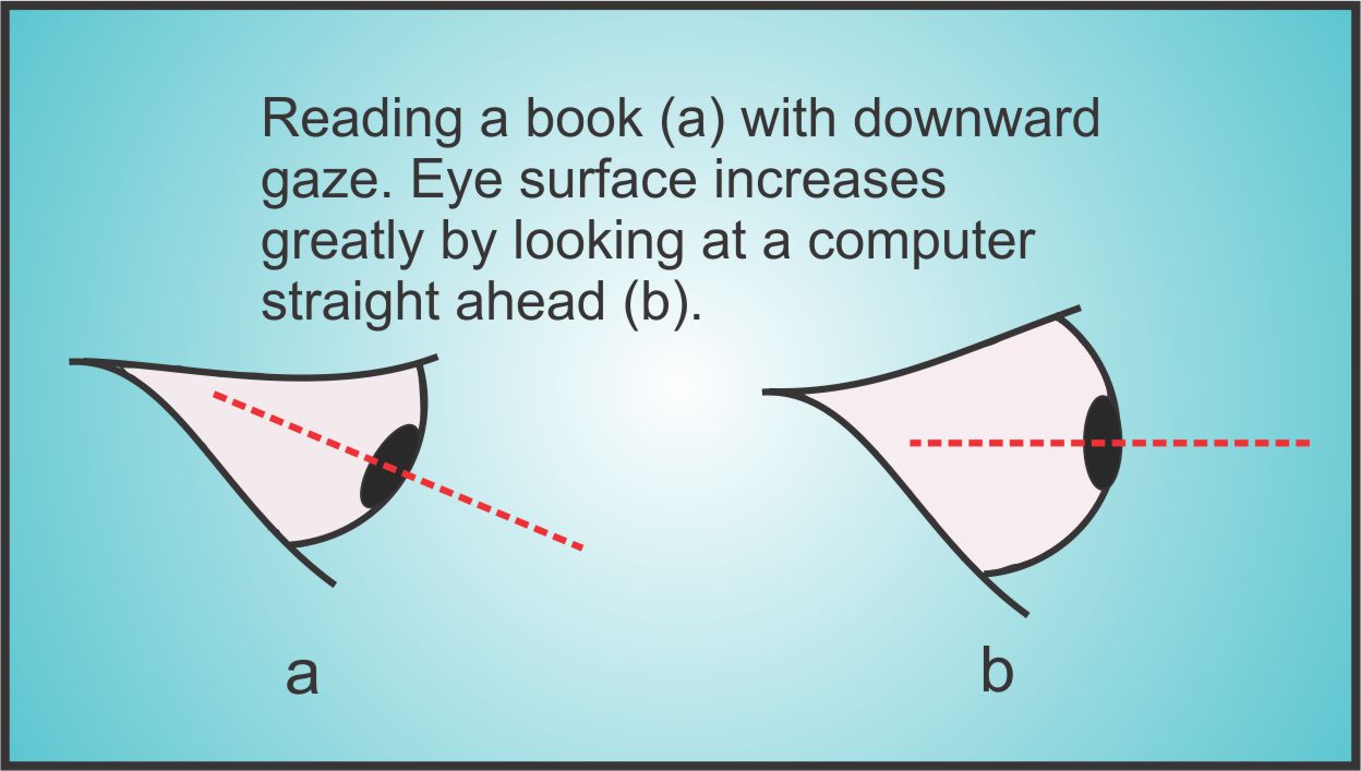 dry eyes are affected by the angle of your eye when reading books, computer or mobile devices